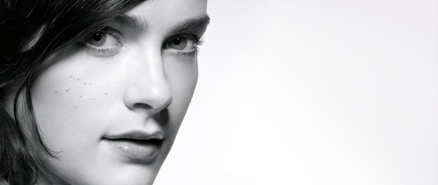 Woman with facial blemish-prone skin