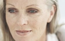 Eucerin: Dry skin | Dry facial skin – how to deal with it