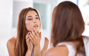 Acne tip number one: do’t fiddle with your face