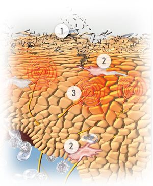 Graphic illustration of skin..