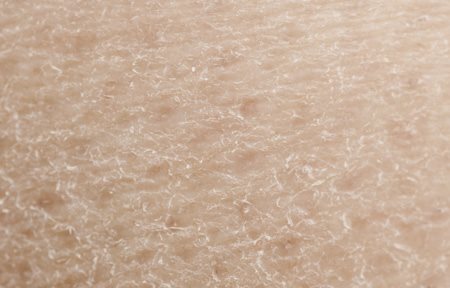Close-up of dry skin