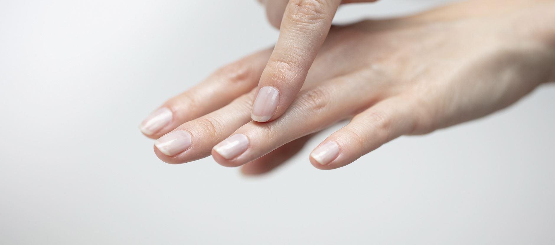 Caring for cracked hands & cuticles