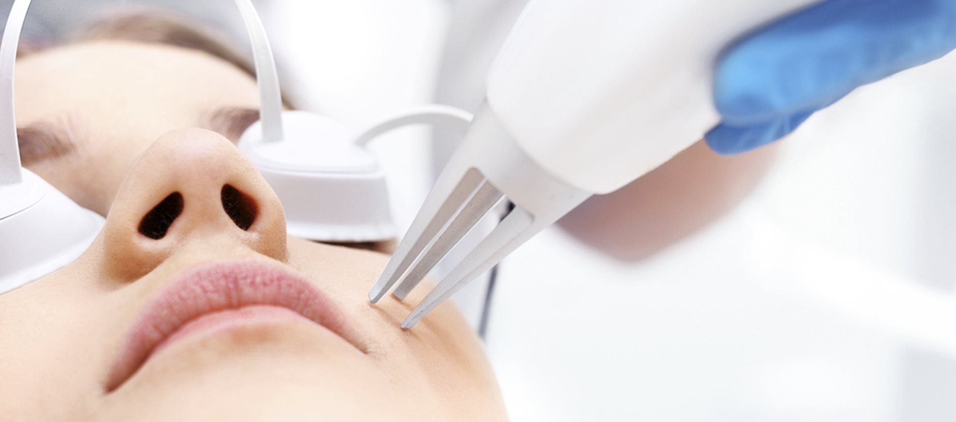Woman receiving facial laser treatment