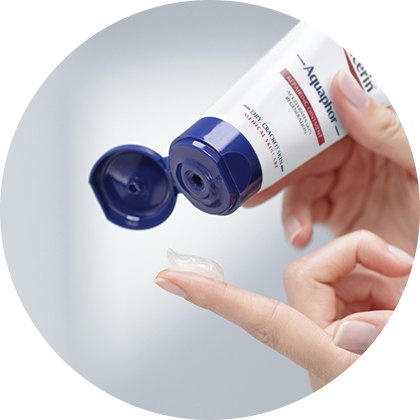 Application of Eucerin Aquaphor Soothing Skin Balm