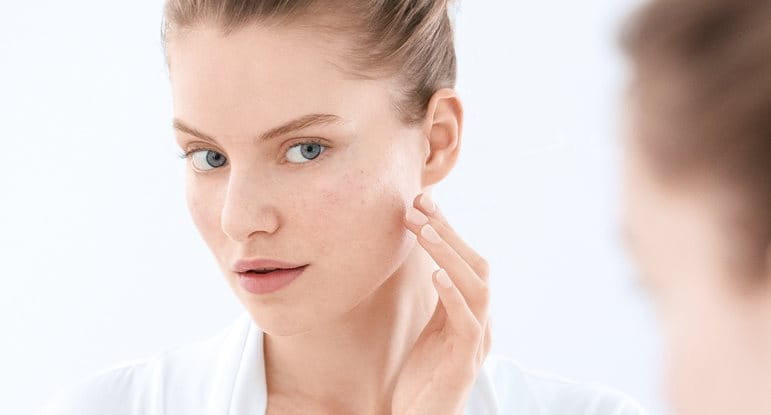 Blemish- and acne- prone skin